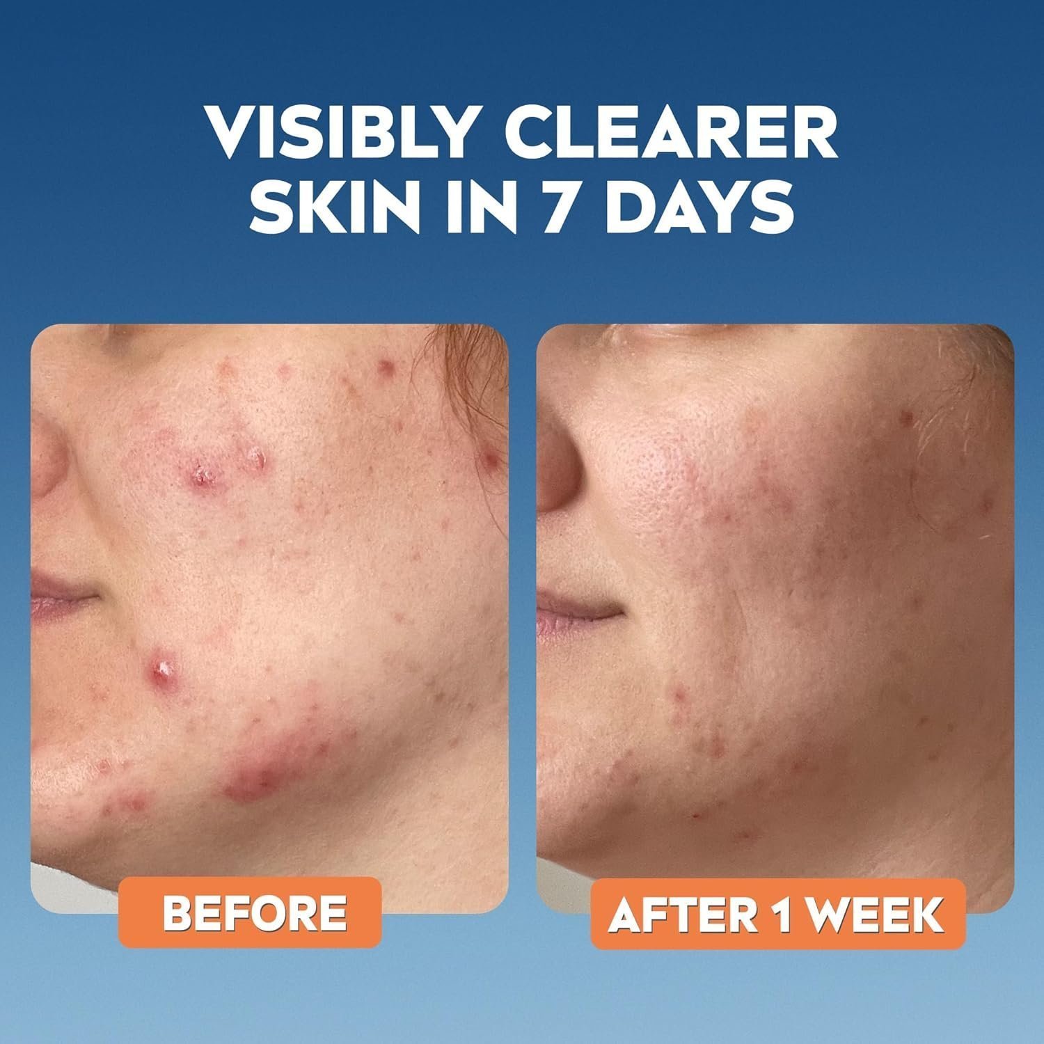 NIVEA Derma Skin Clear Wash Gel (150ml) - Image 4